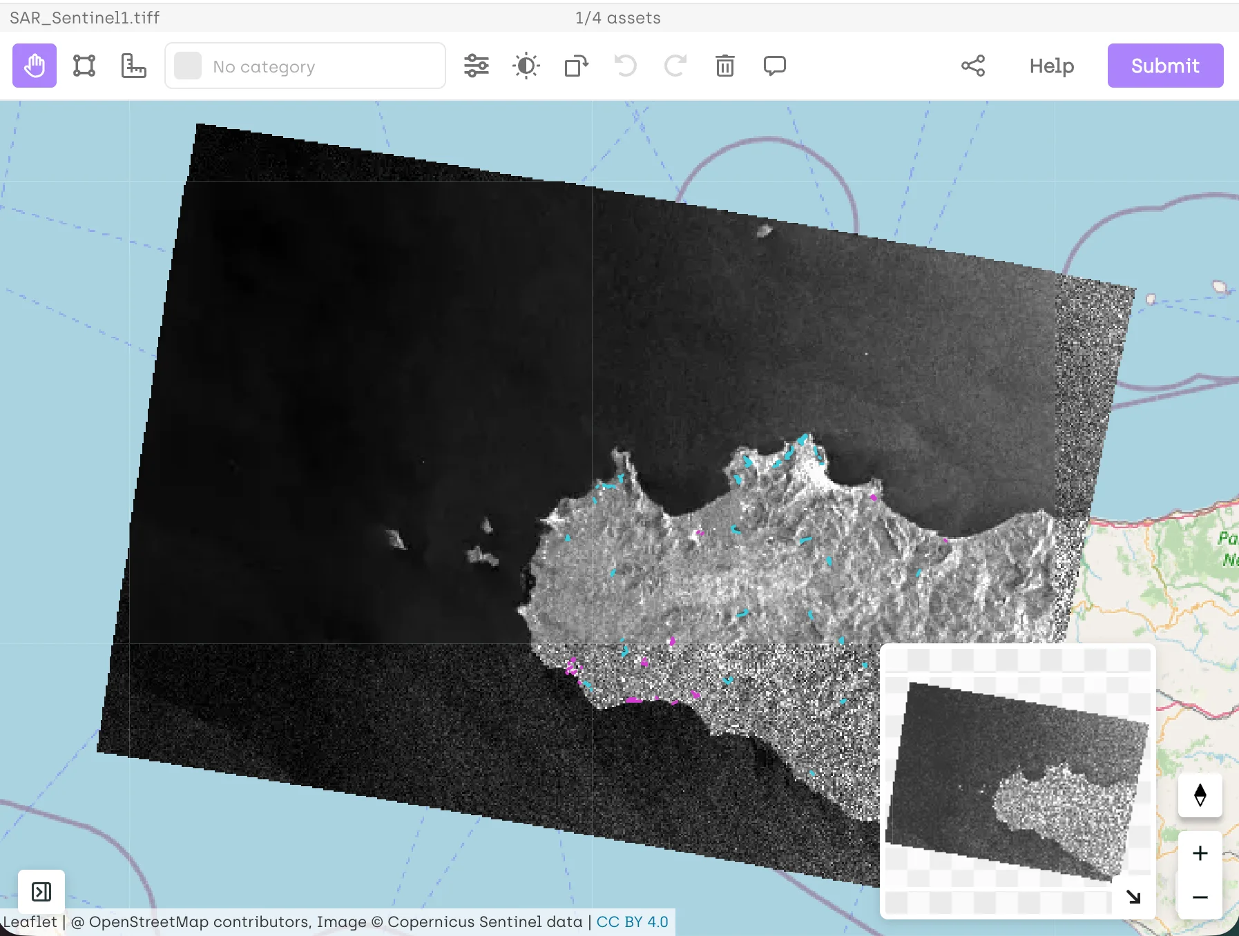 Product photo of breast cell segmentation on Kili Technology's platform