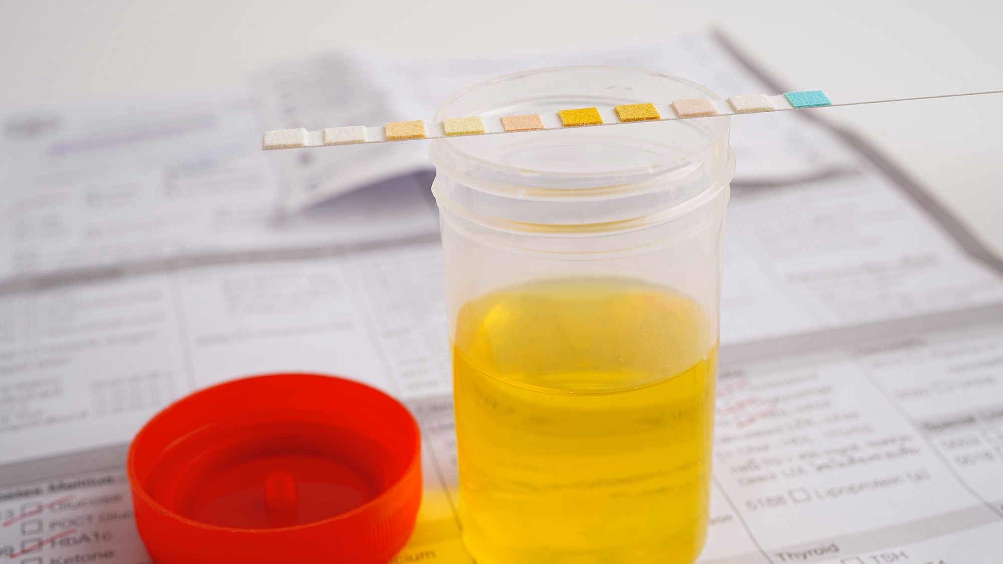 Advanced Urine Organic Acids Test (UOA)