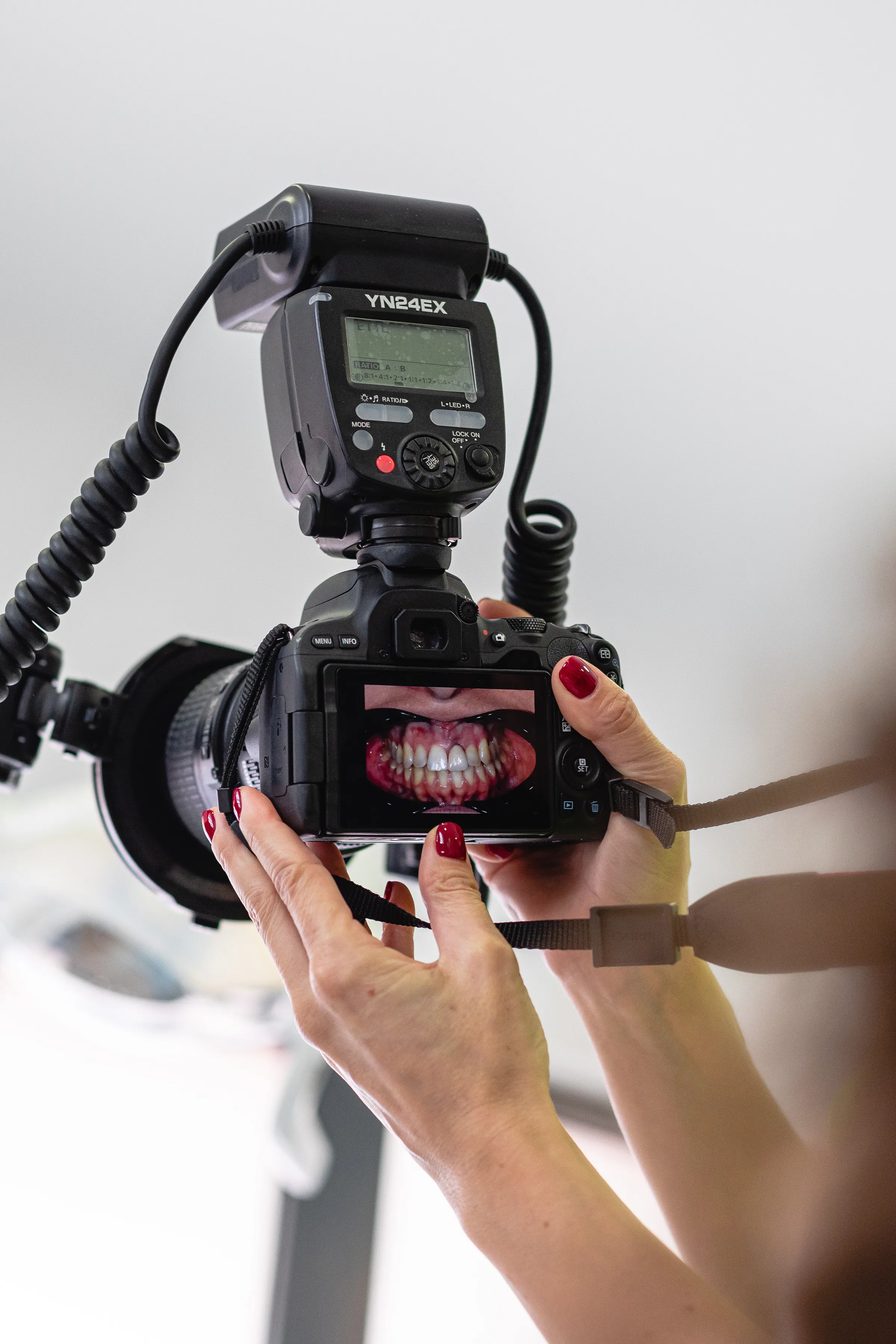 Mãos femininas a segurar uma máquina fotográfica com flash acoplado, exibindo no ecrã uma imagem detalhada de dentes e gengivas de paciente.