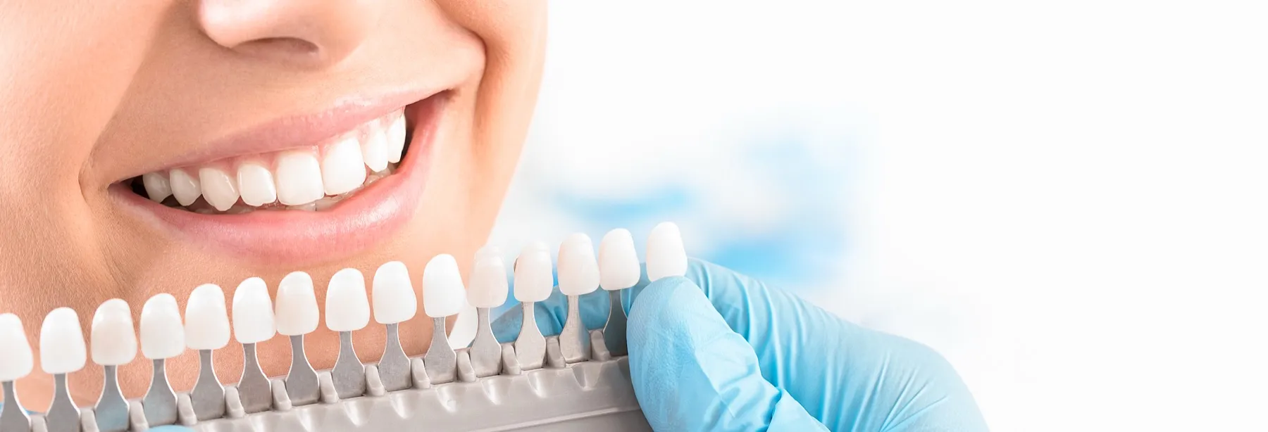 Close-up of a smiling person’s white teeth being compared to a dental shade guide held by a gloved hand.