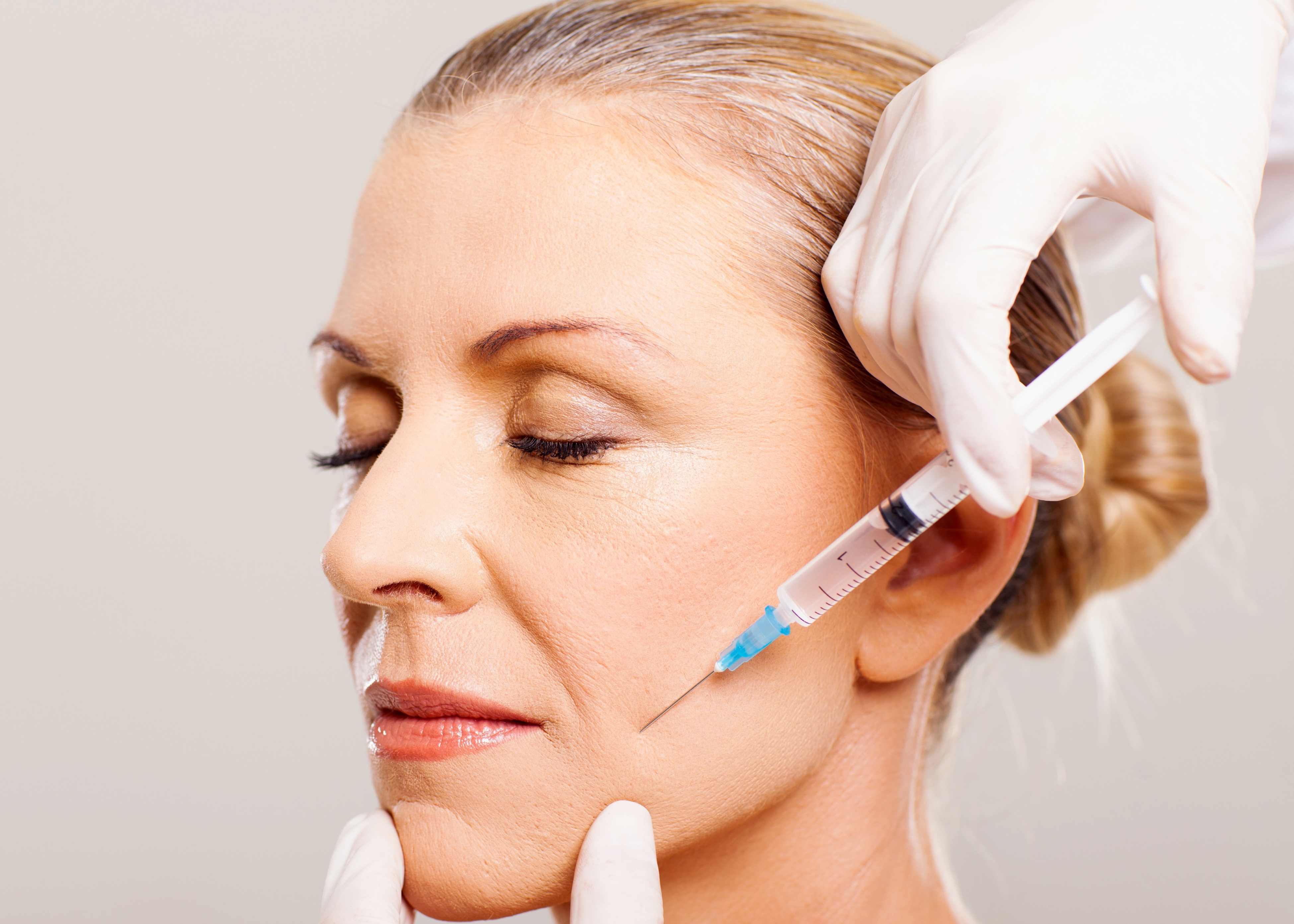 A woman getting Dermal Filler
