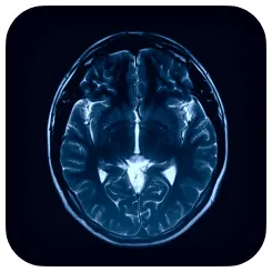 A mri image of a human brain.