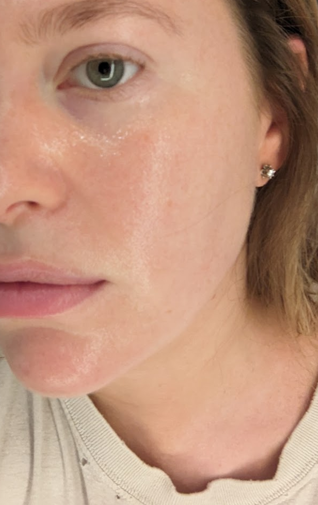 Close-up of a woman's face showing clear skin with a small stud earring and light-colored shirt.
