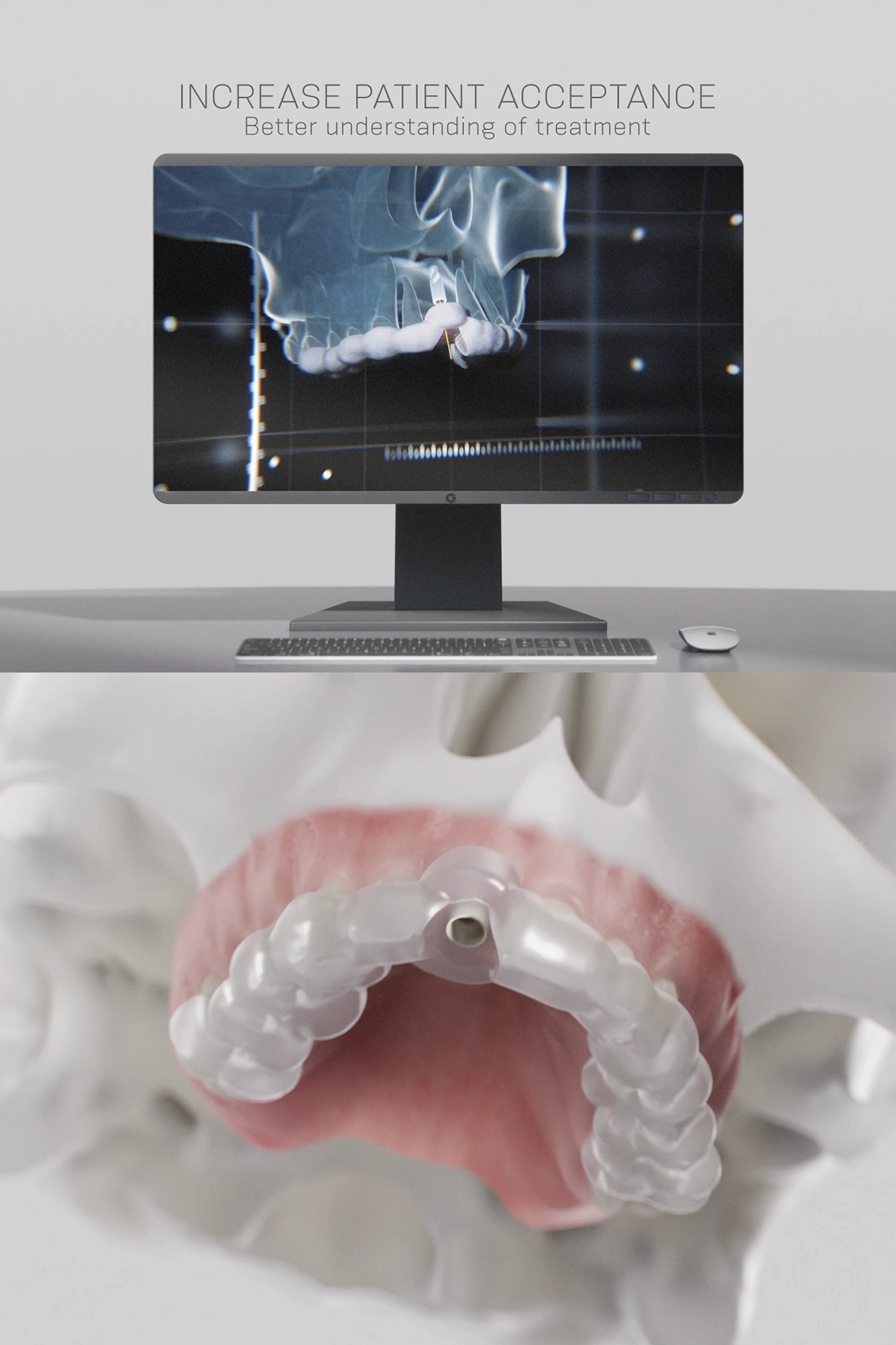 Neodent Zi Guided