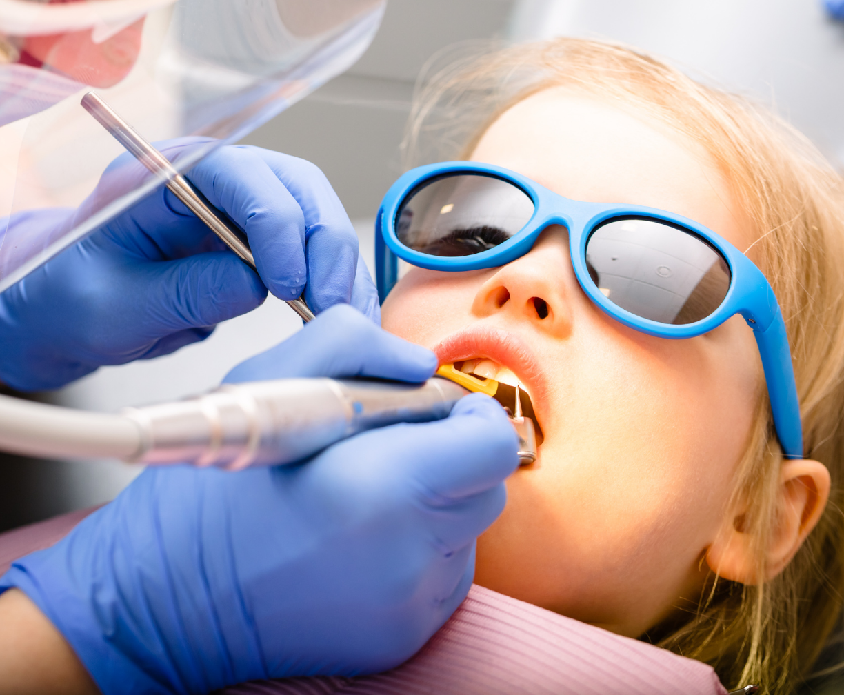 Child wearing blue sunglasses receiving a dental treatment with a dental tool from a dentist wearing blue gloves.