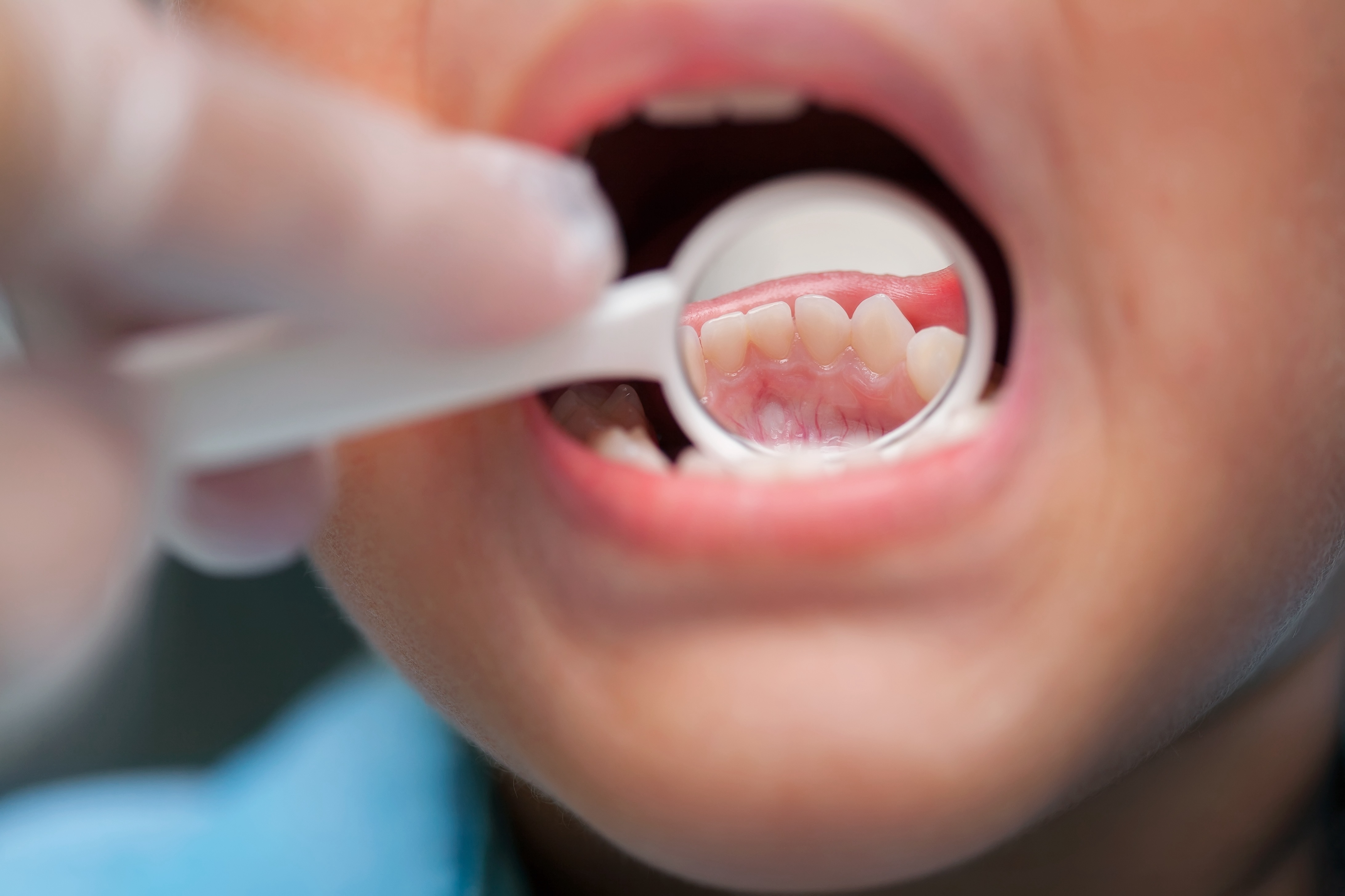 Smiling boy in striped shirt sitting in a dental chair pointing to his teeth.