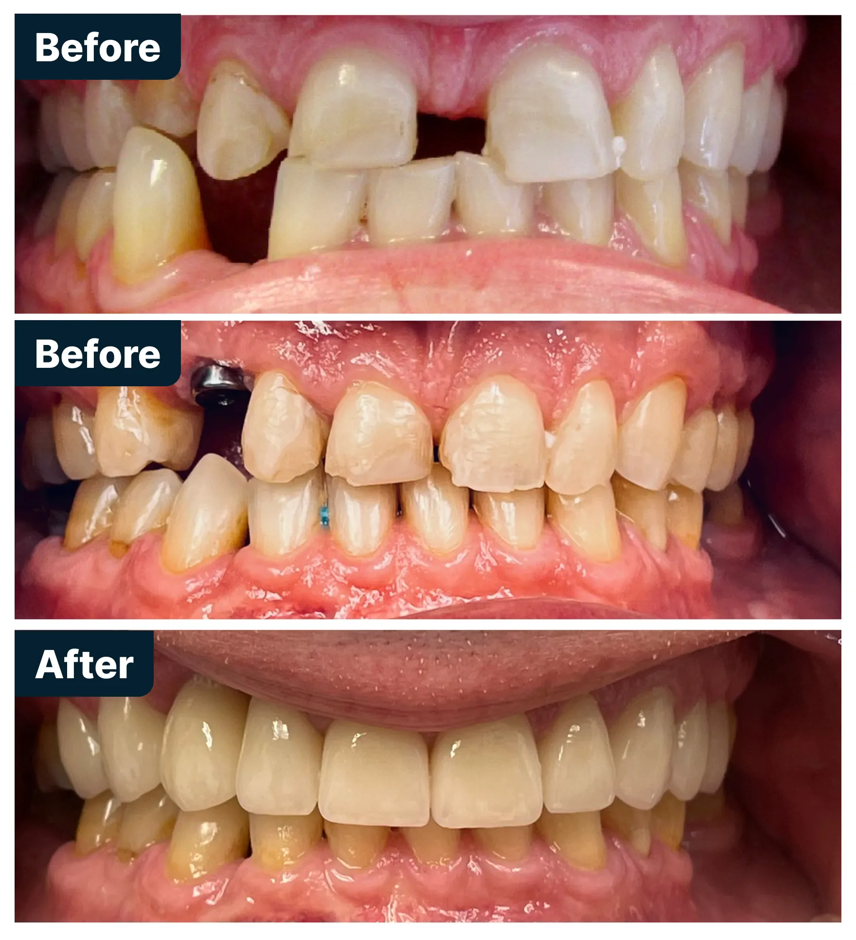 Before and After Treatment