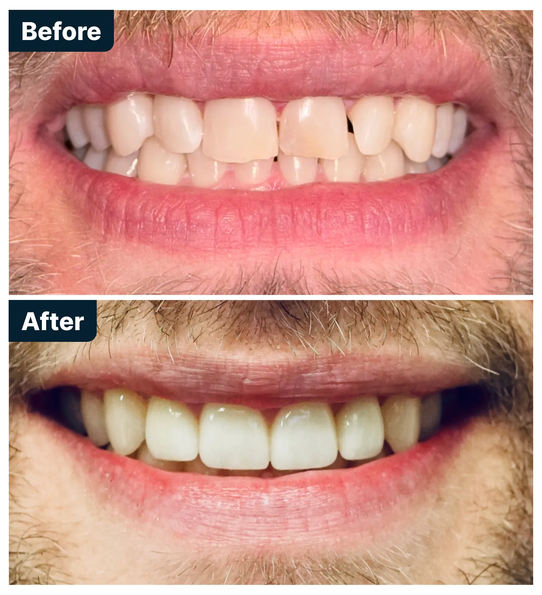 Before and After Treatment