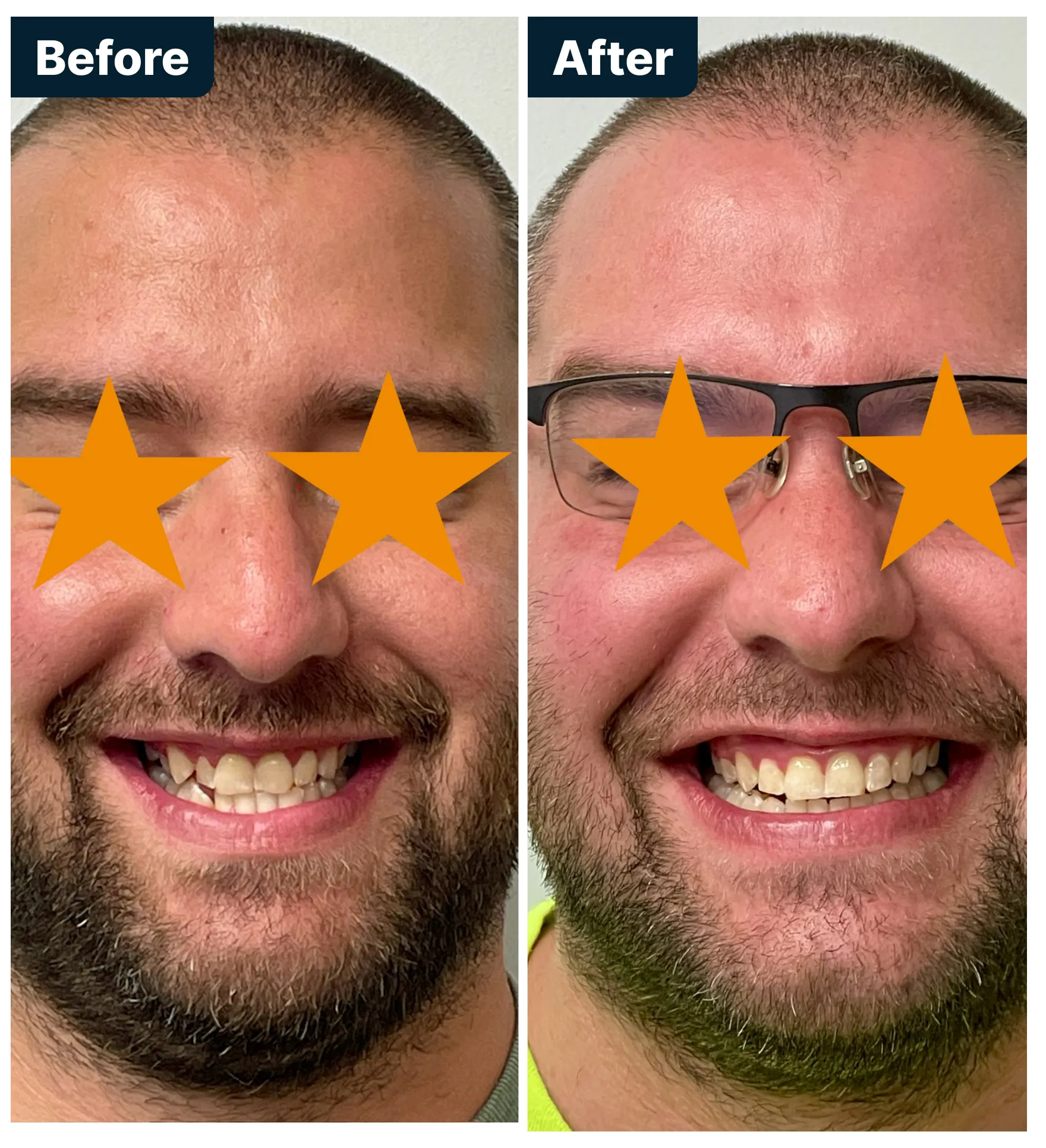 Before and After Treatment