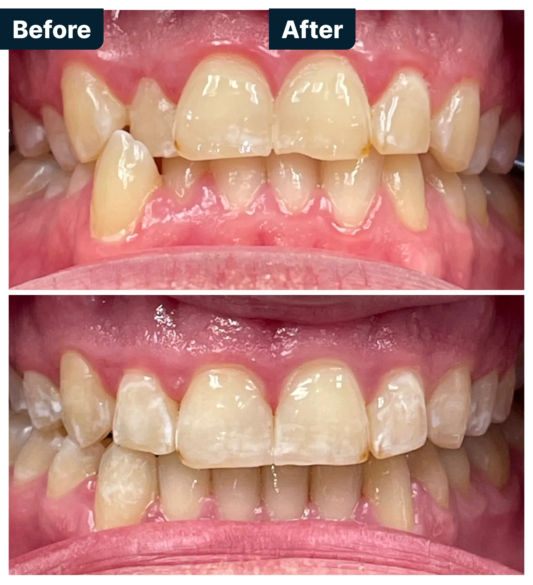 Before and After Treatment