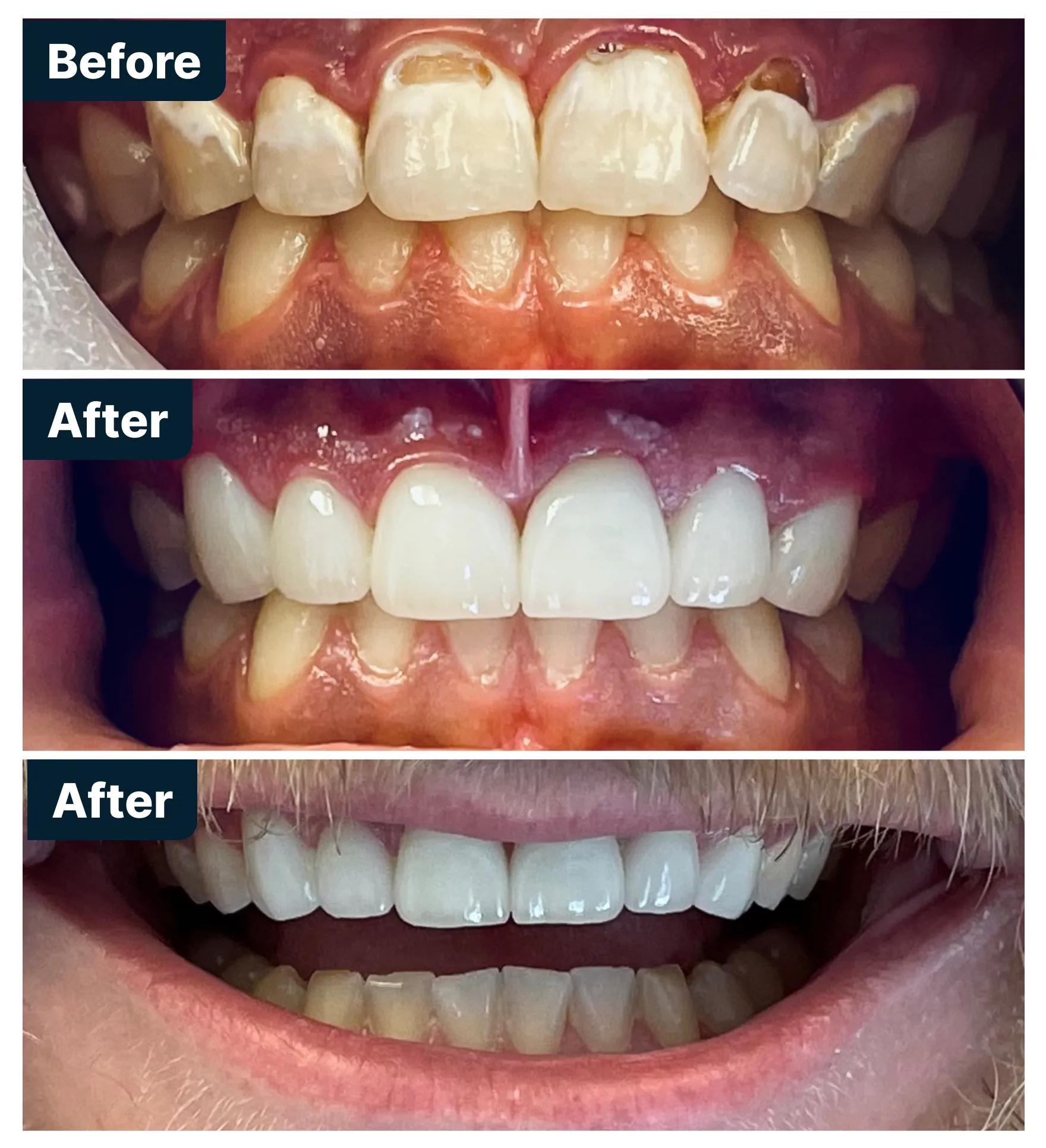 Before and After Treatment