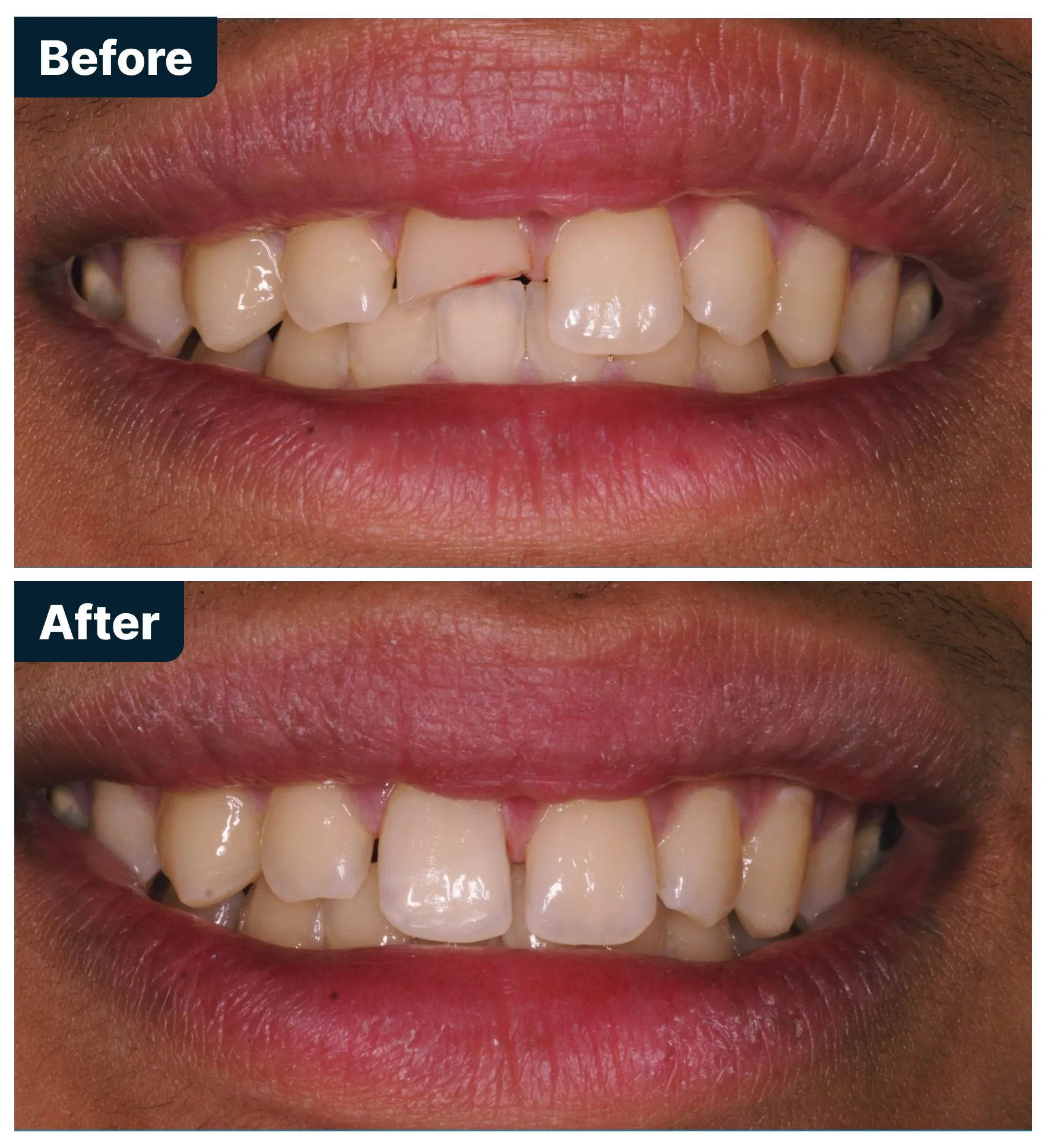 Before and After Treatment