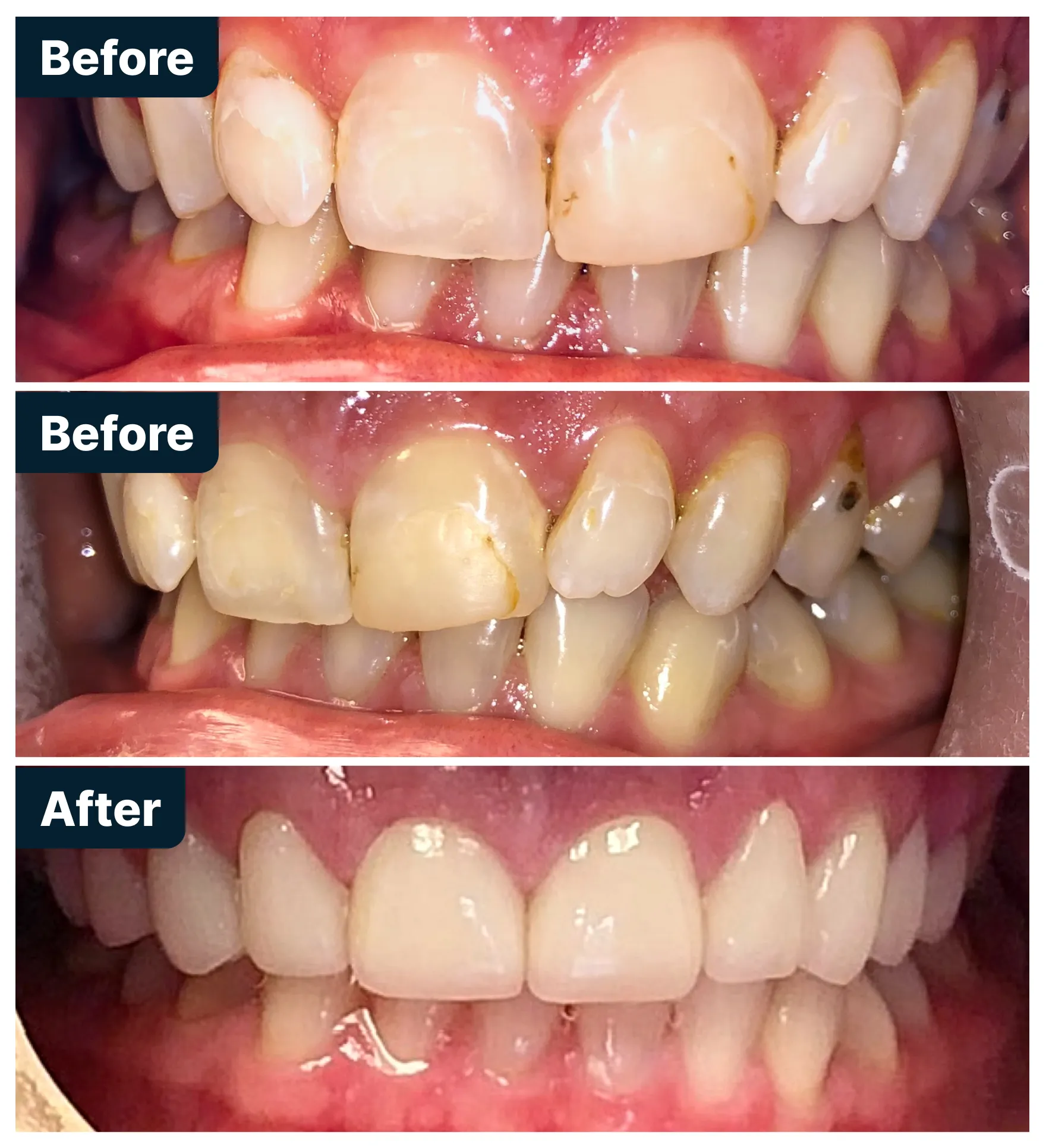 Before and After Treatment