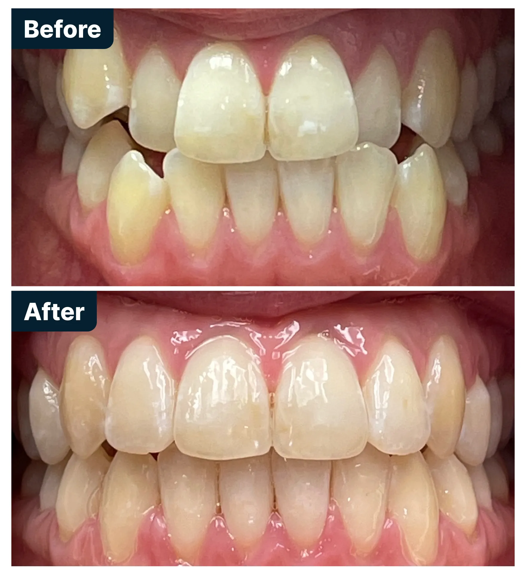 Before and After Treatment