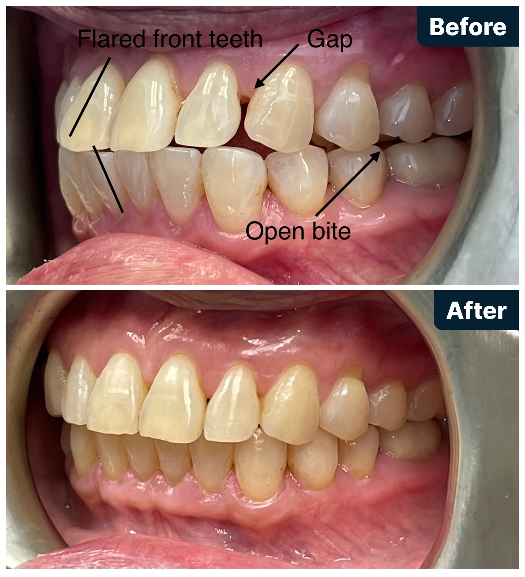 Before and After Treatment