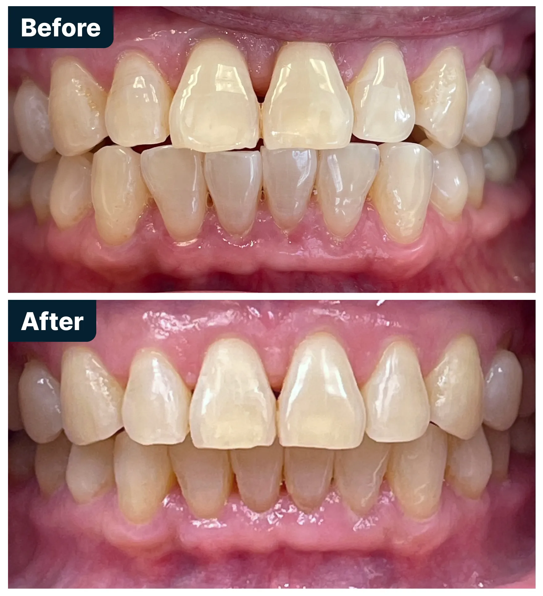 Before and After Treatment