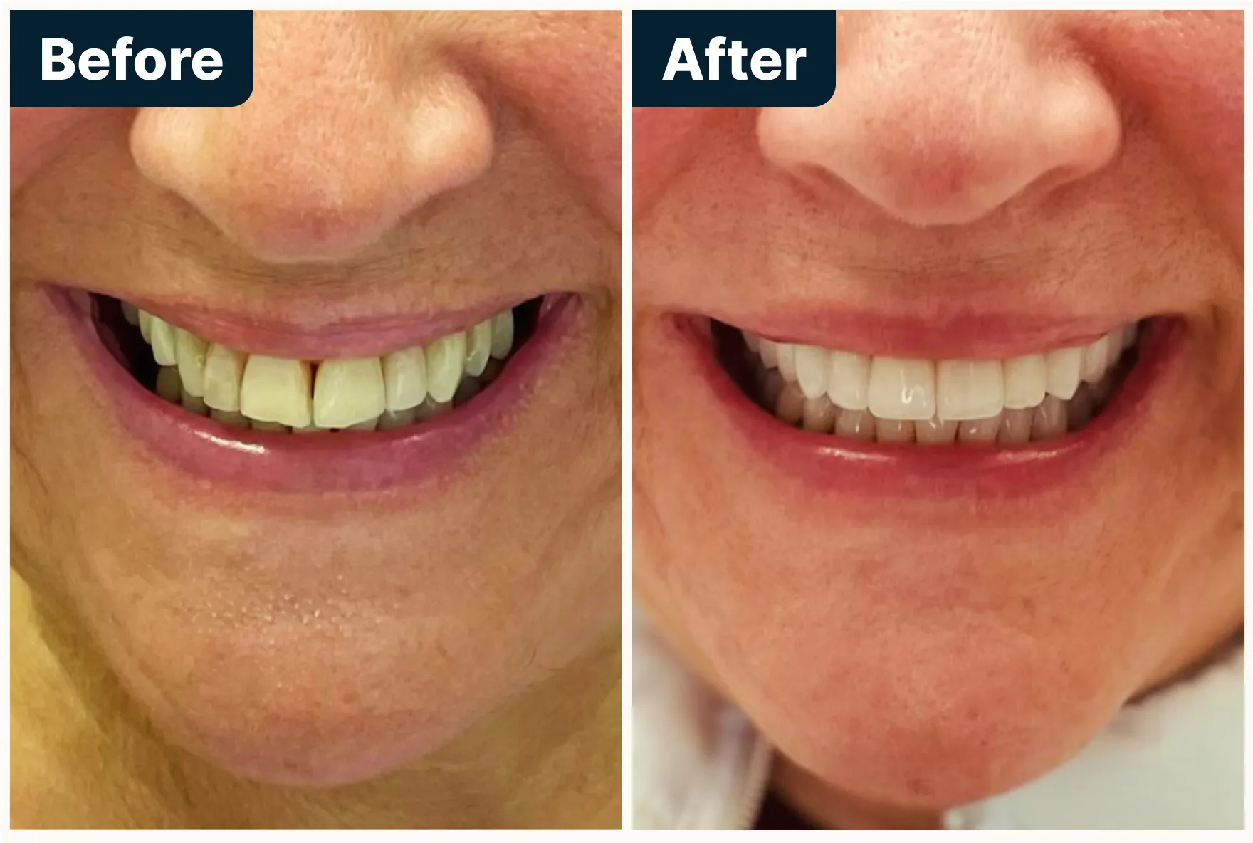 Before and After Treatment