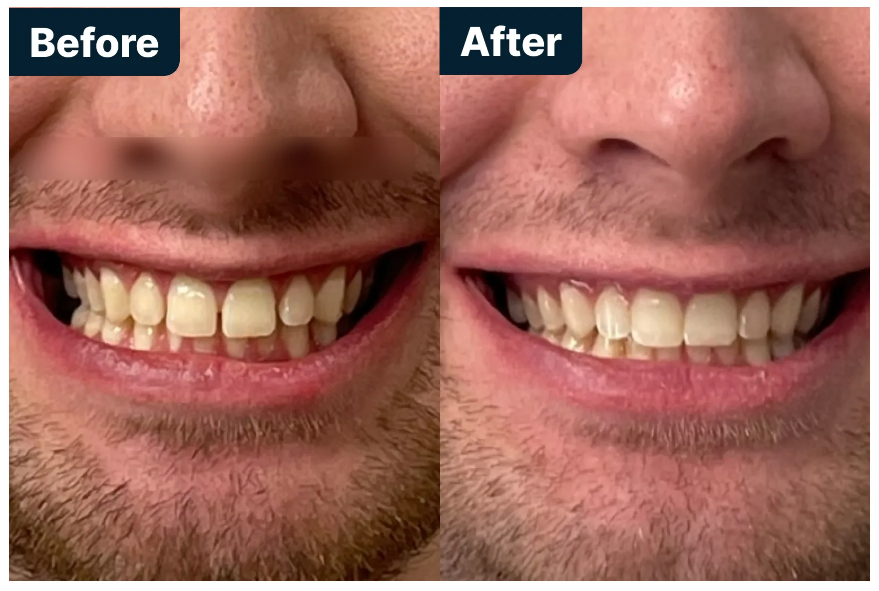 Before and After Treatment