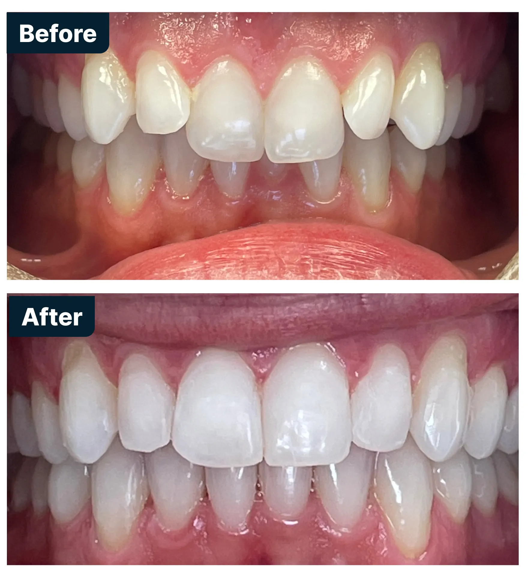 Before and After Treatment