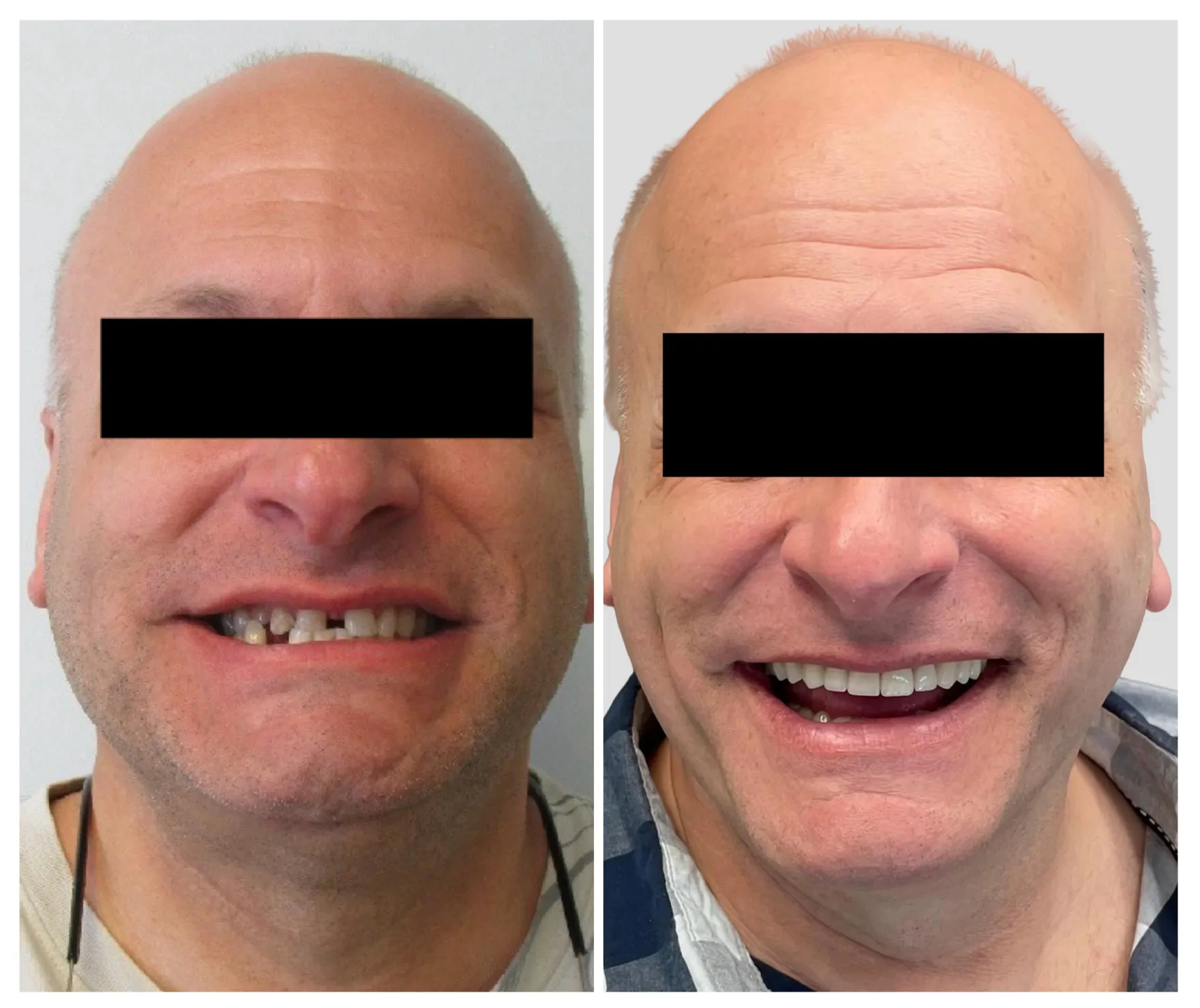 Before and After Treatment