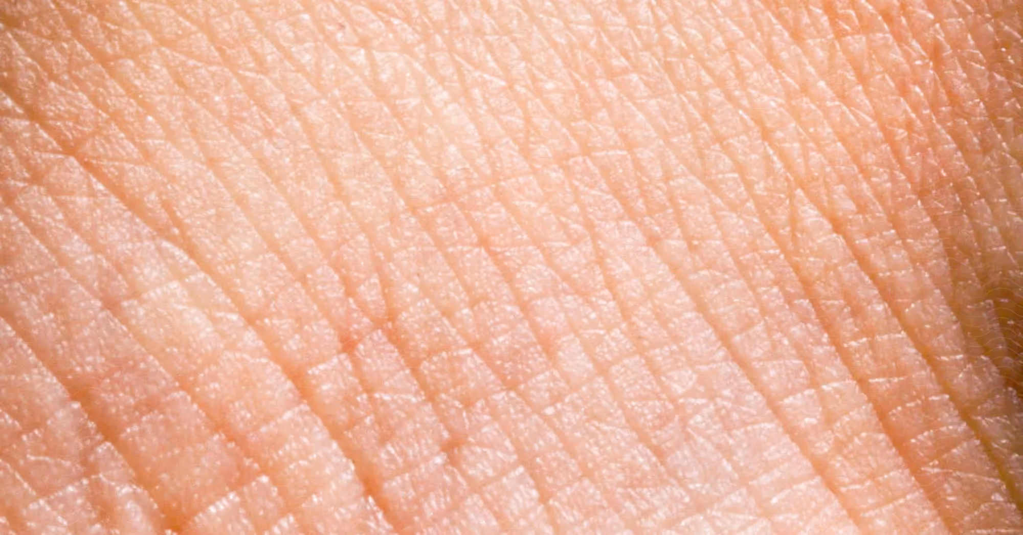 Close-up of aged skin showing visible texture and fine lines.