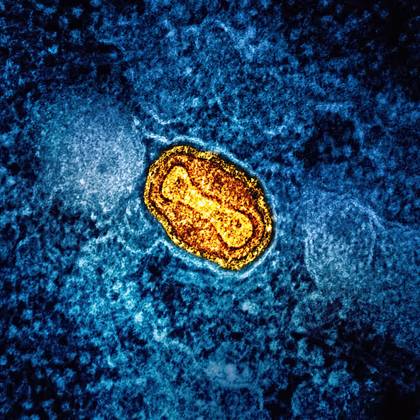 Microscopic image of blue and yellow cells under magnification