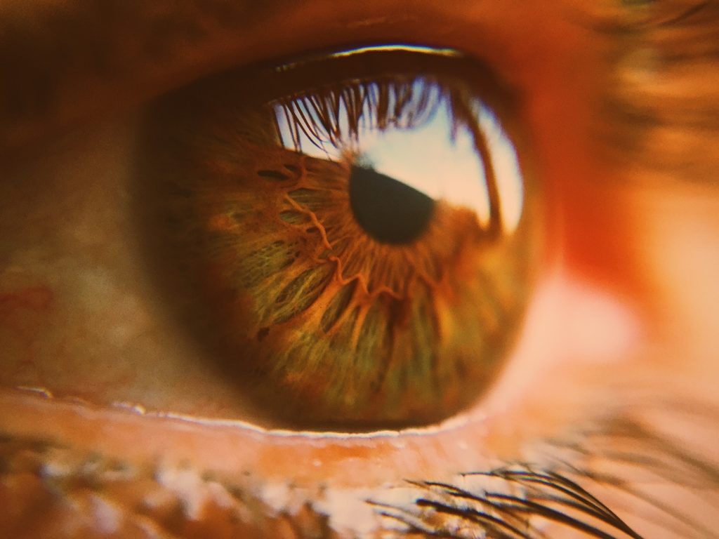 Macro eyeball