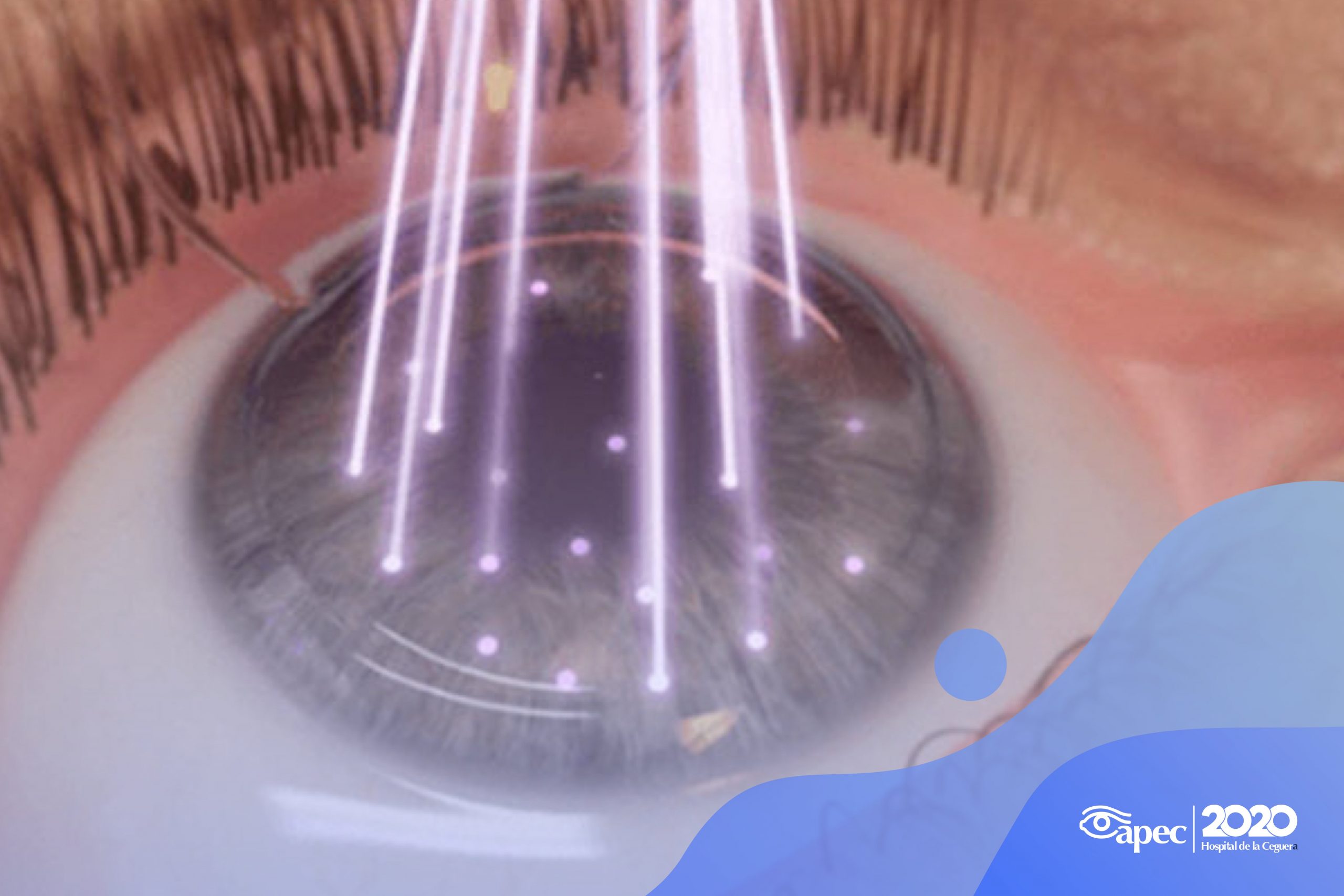 Young woman wearing glasses smiles