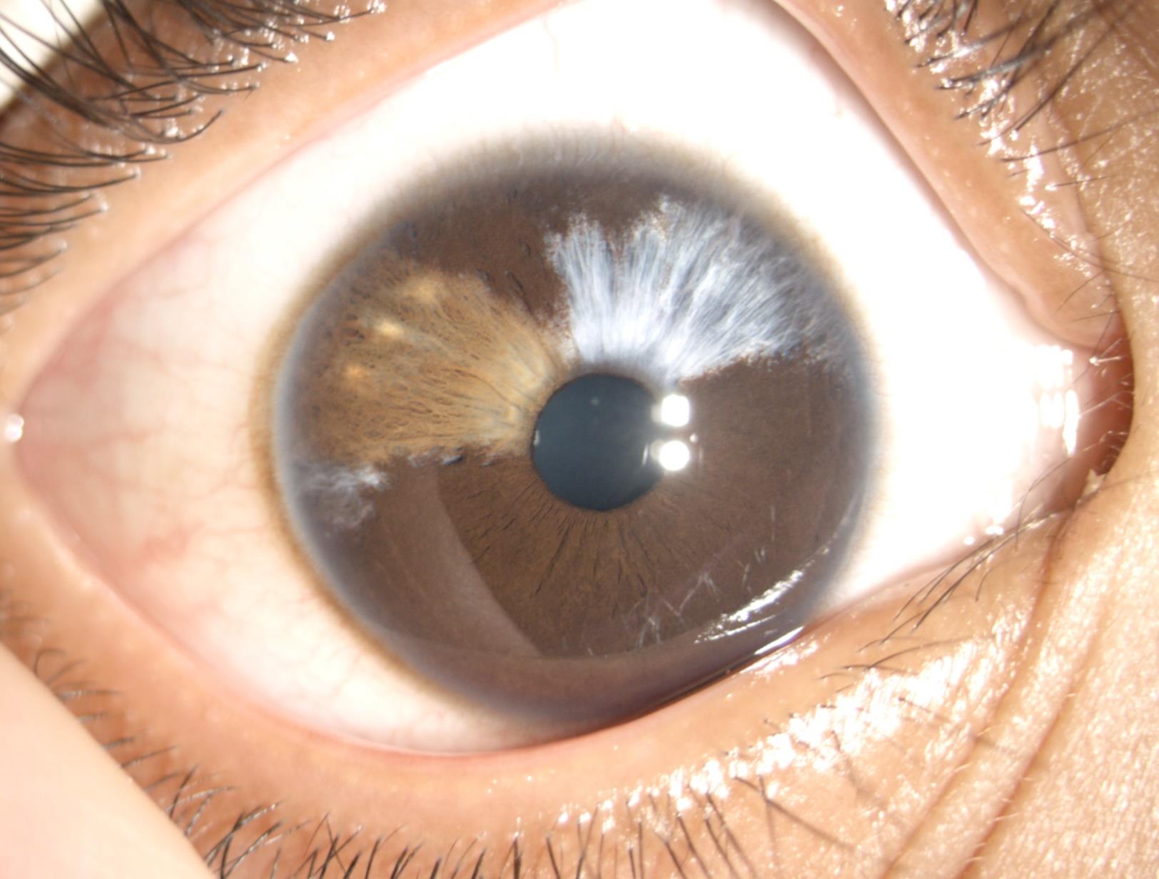 Young woman wearing glasses smiles