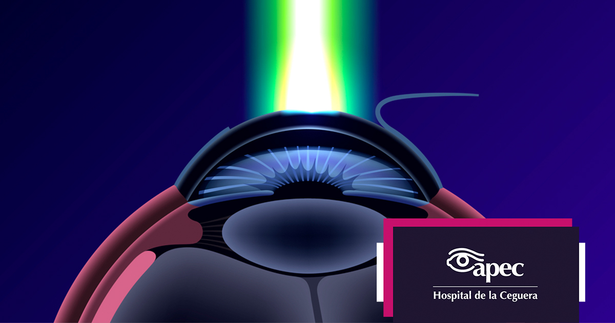 Young woman wearing glasses smiles