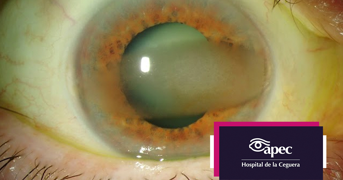 Young woman wearing glasses smiles