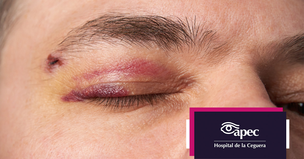 Young woman wearing glasses smiles