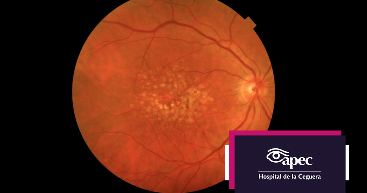 Young woman wearing glasses smiles