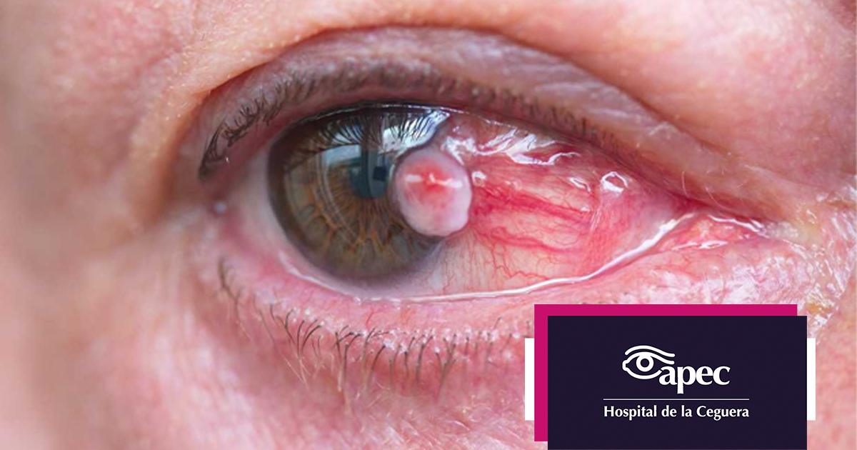 Young woman wearing glasses smiles