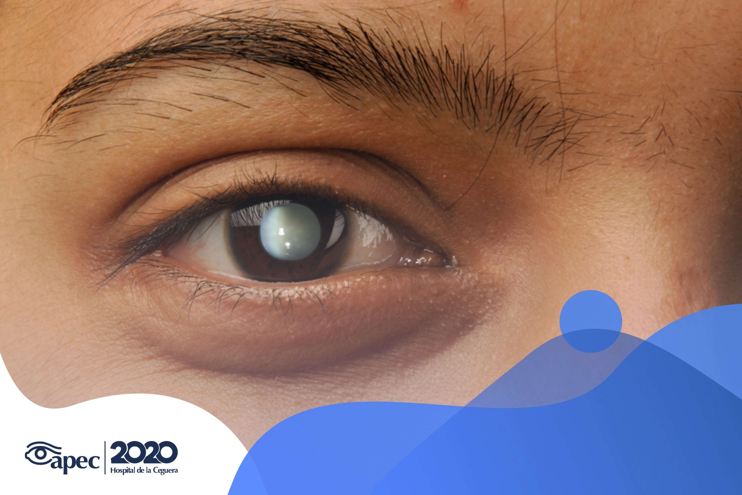 Young woman wearing glasses smiles