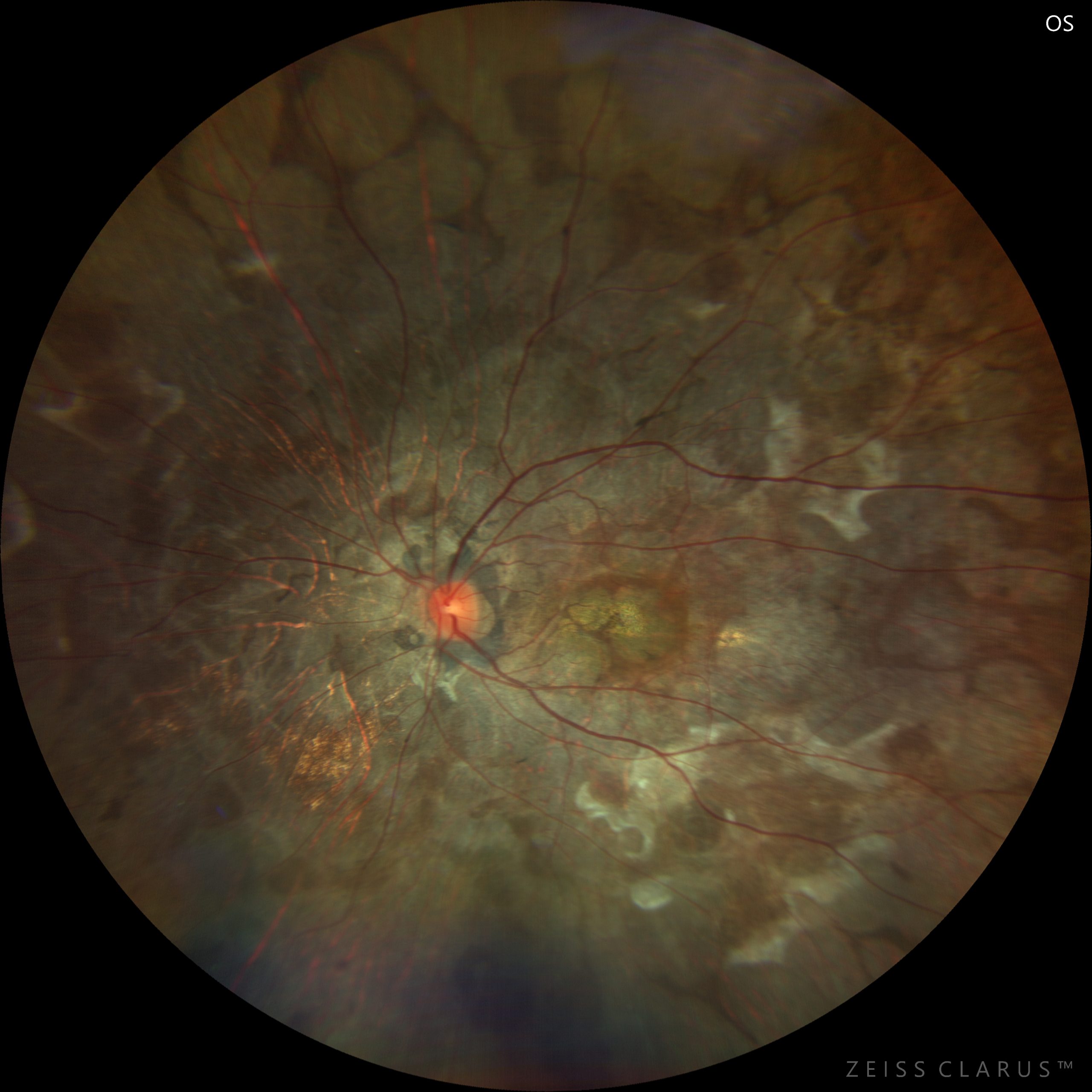 Young woman wearing glasses smiles