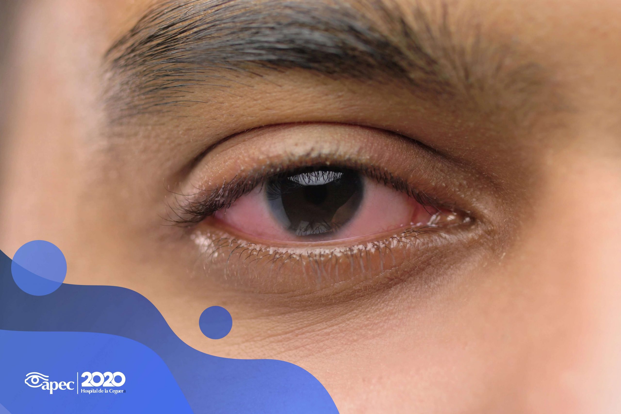 Young woman wearing glasses smiles