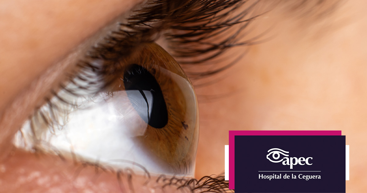 Young woman wearing glasses smiles