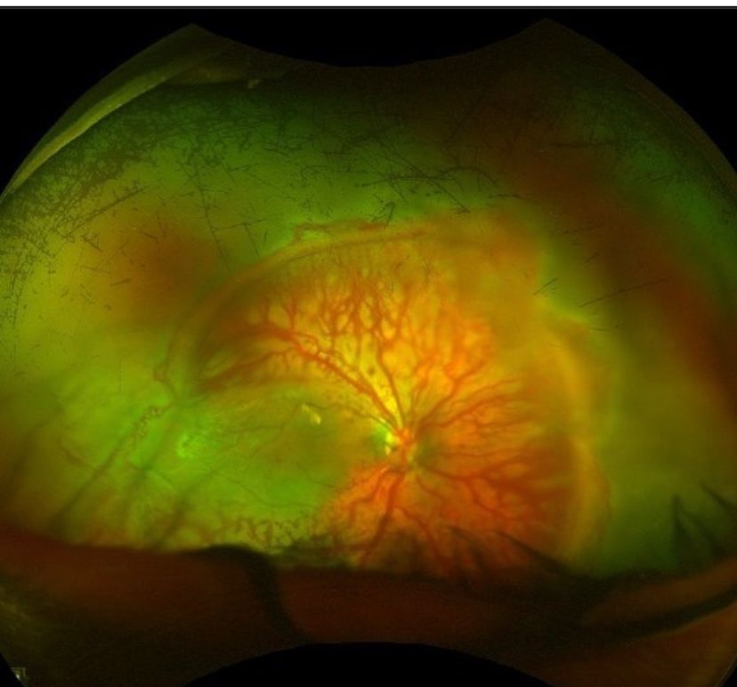 Young woman wearing glasses smiles