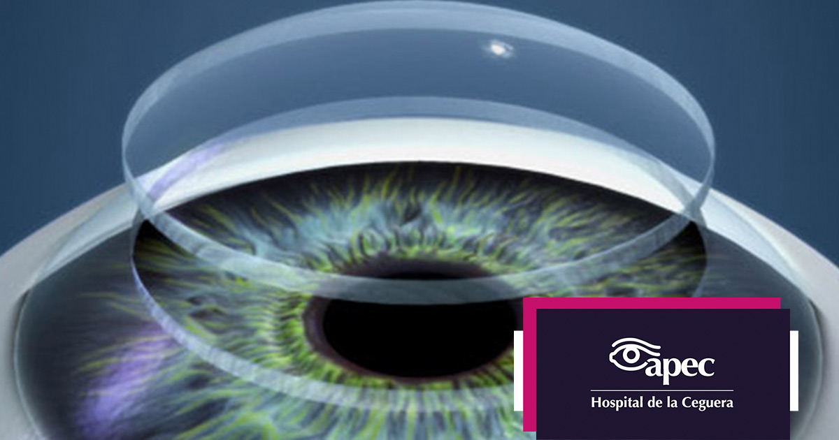 Young woman wearing glasses smiles