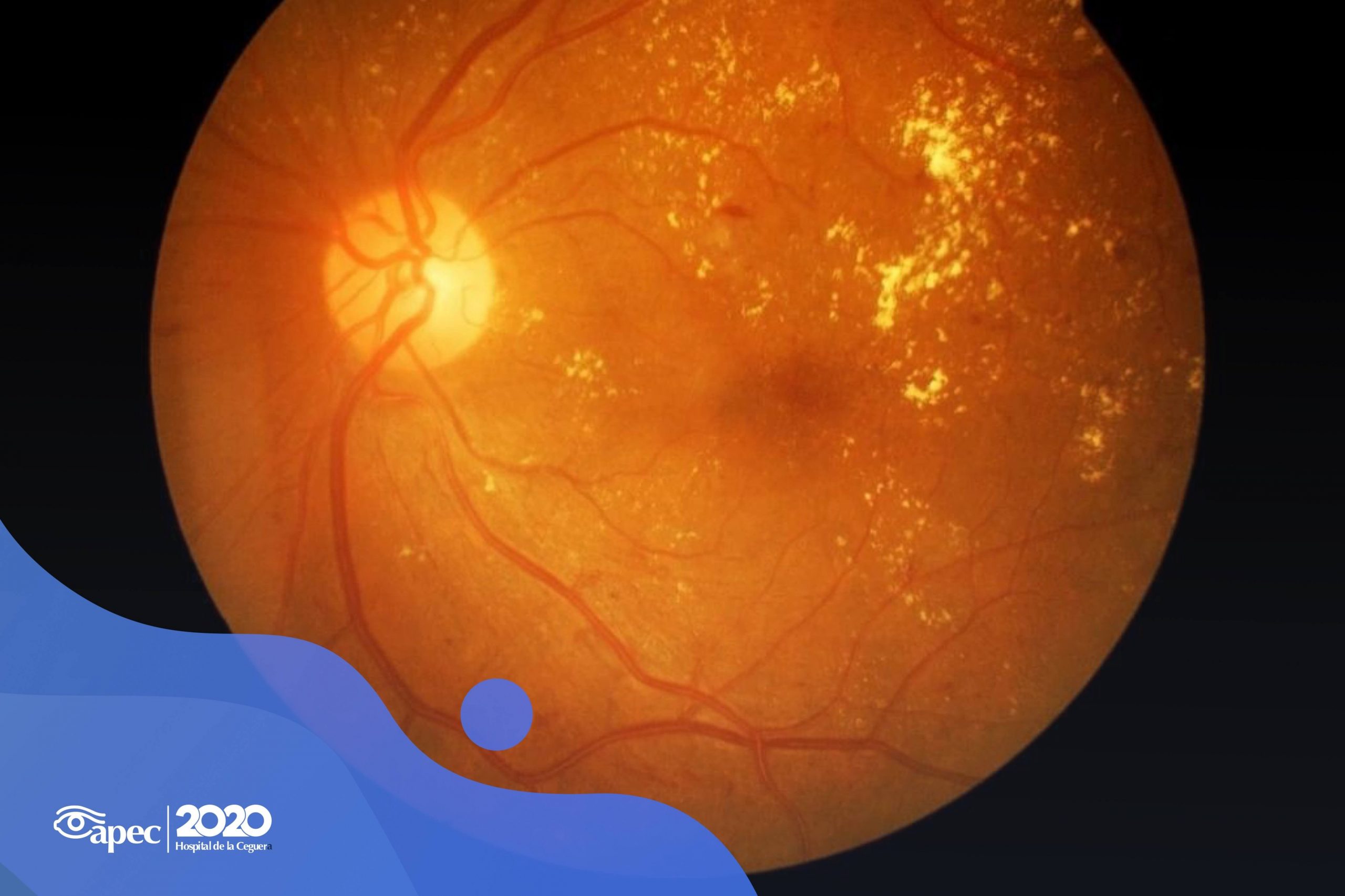 Young woman wearing glasses smiles