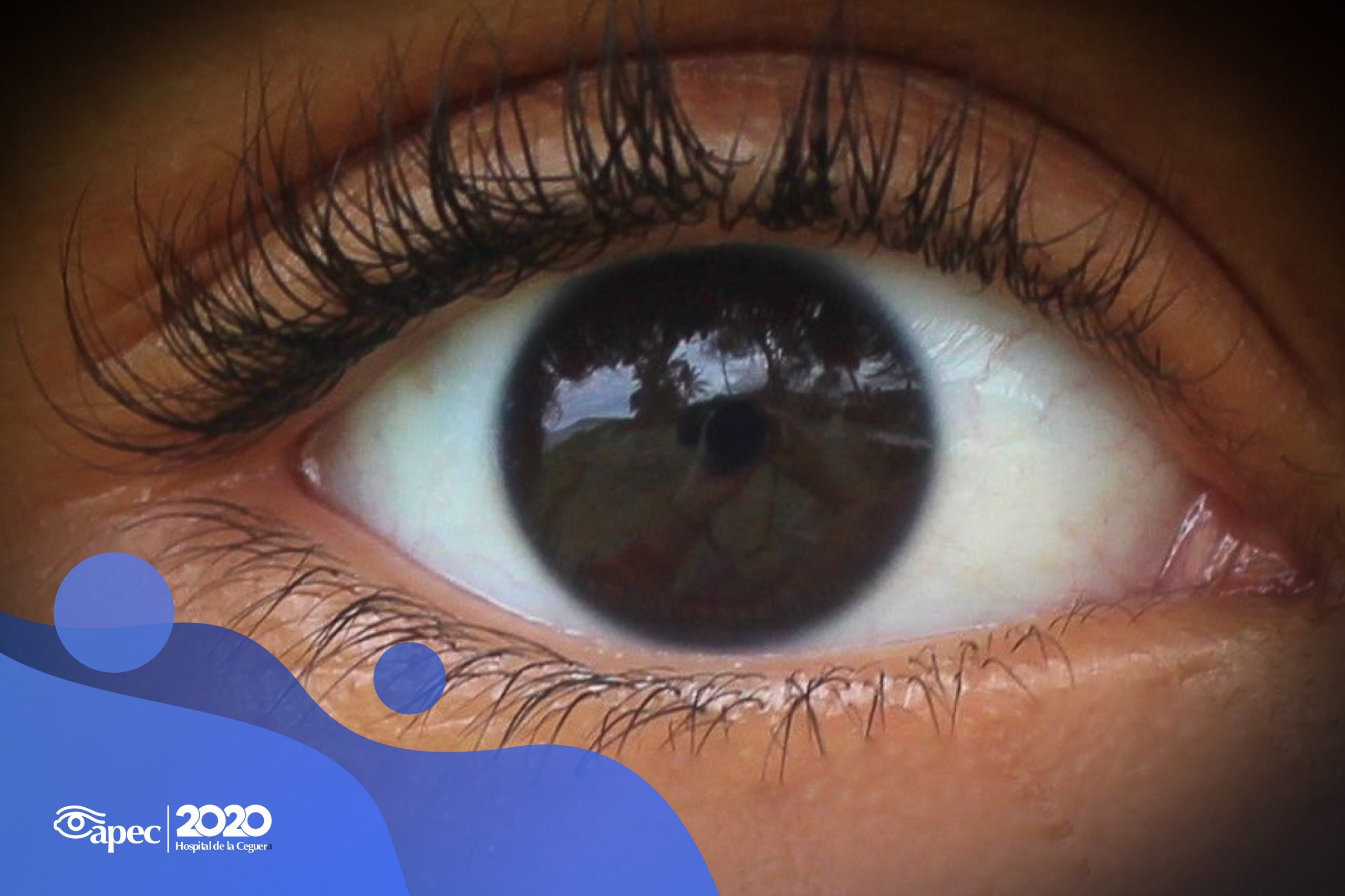 Young woman wearing glasses smiles