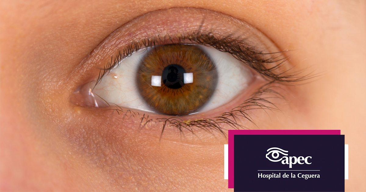 Young woman wearing glasses smiles