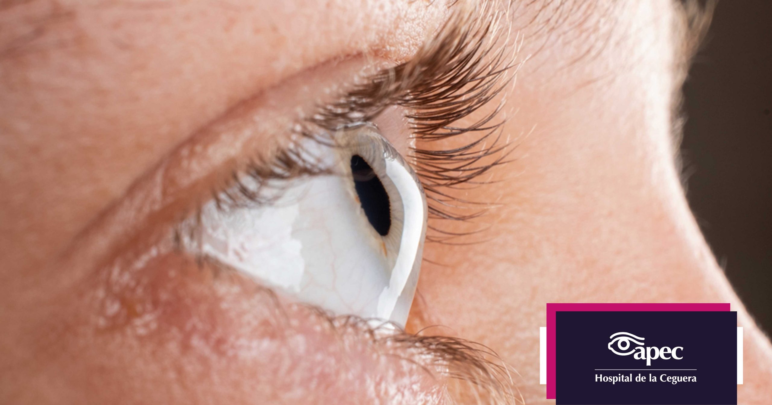 Young woman wearing glasses smiles