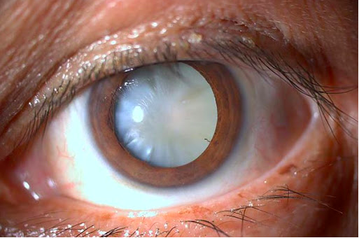 Young woman wearing glasses smiles