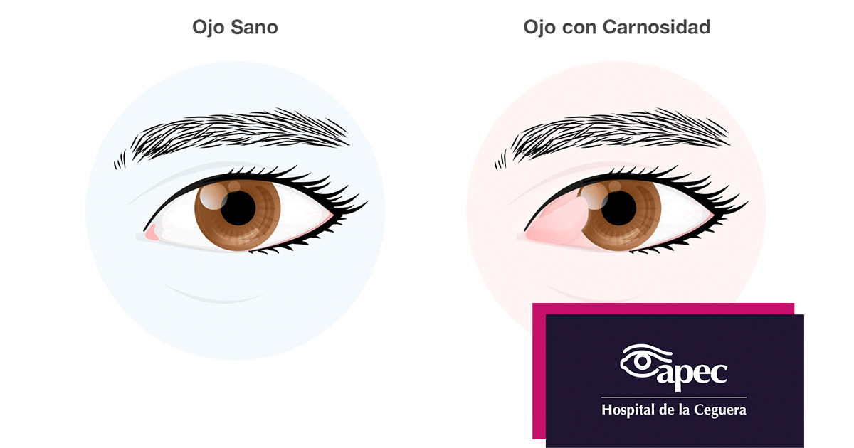 Young woman wearing glasses smiles