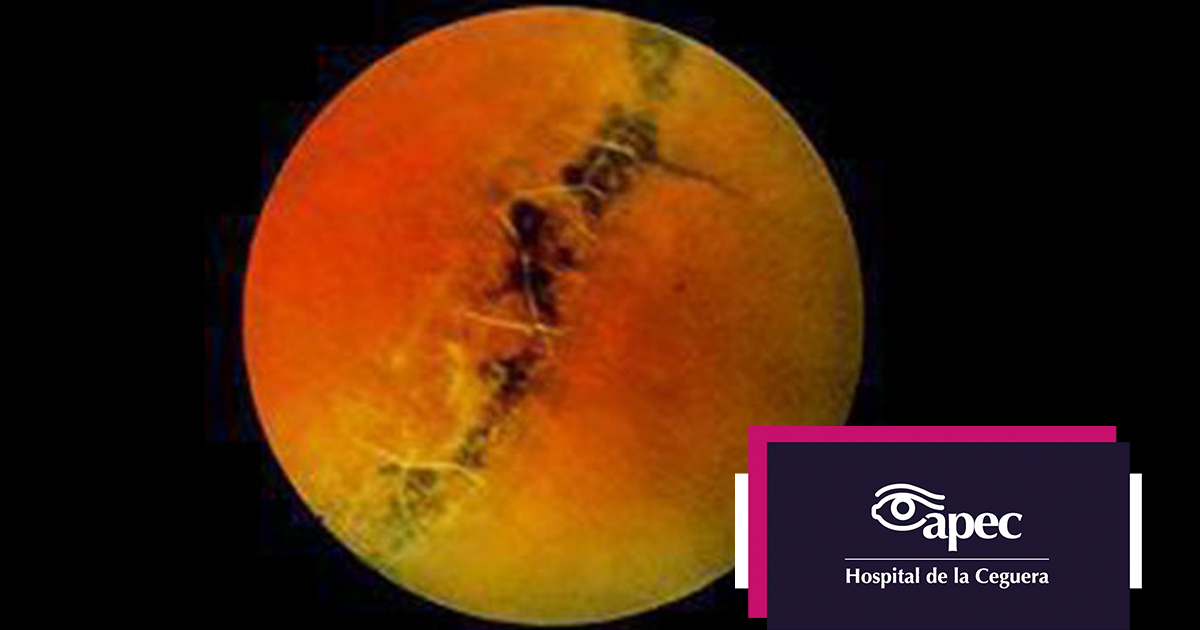 Young woman wearing glasses smiles