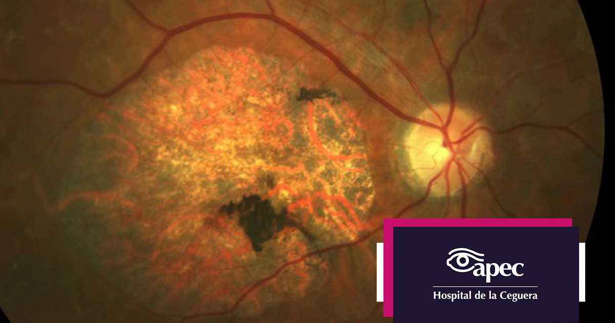 Young woman wearing glasses smiles