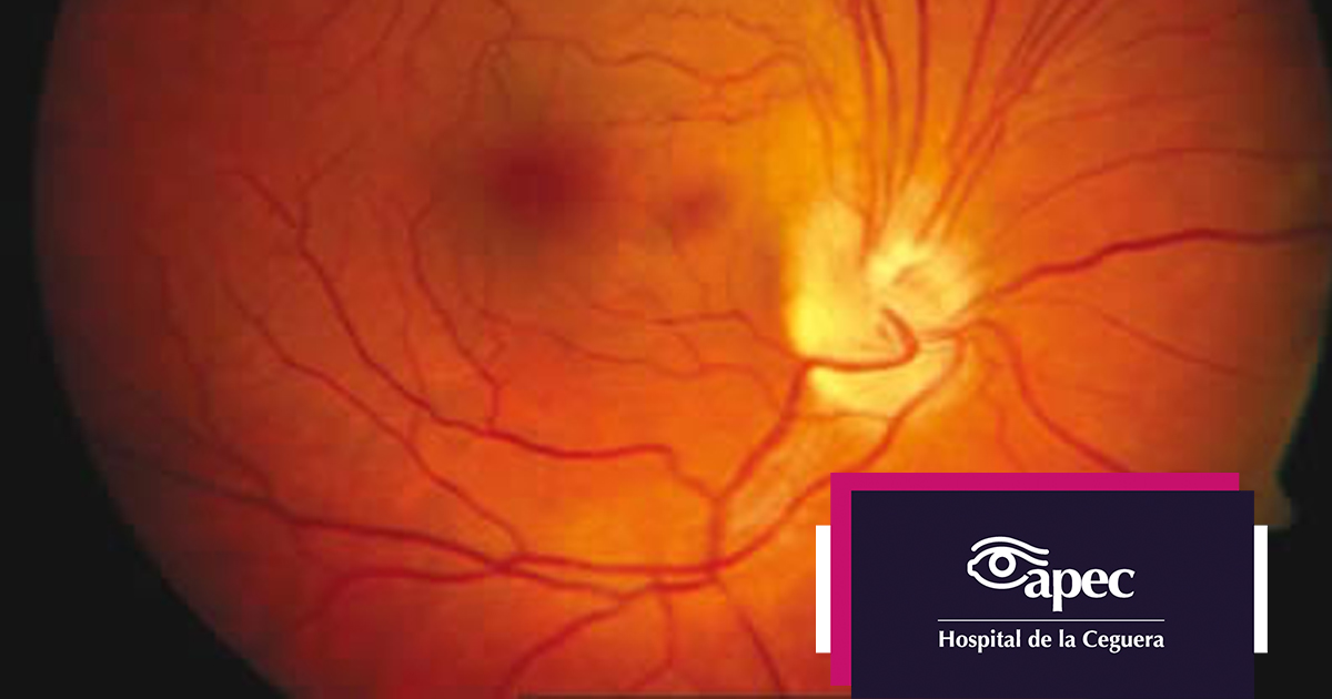 Young woman wearing glasses smiles