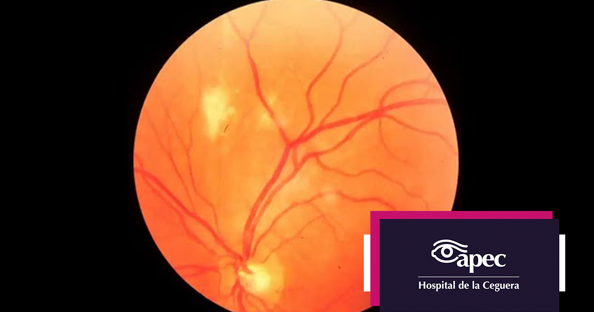 Young woman wearing glasses smiles